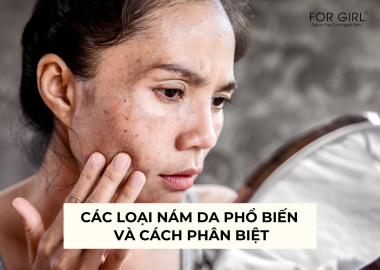 CÁC LOẠI NÁM DA PHỔ BIẾN VÀ CÁCH PHÂN BIỆT